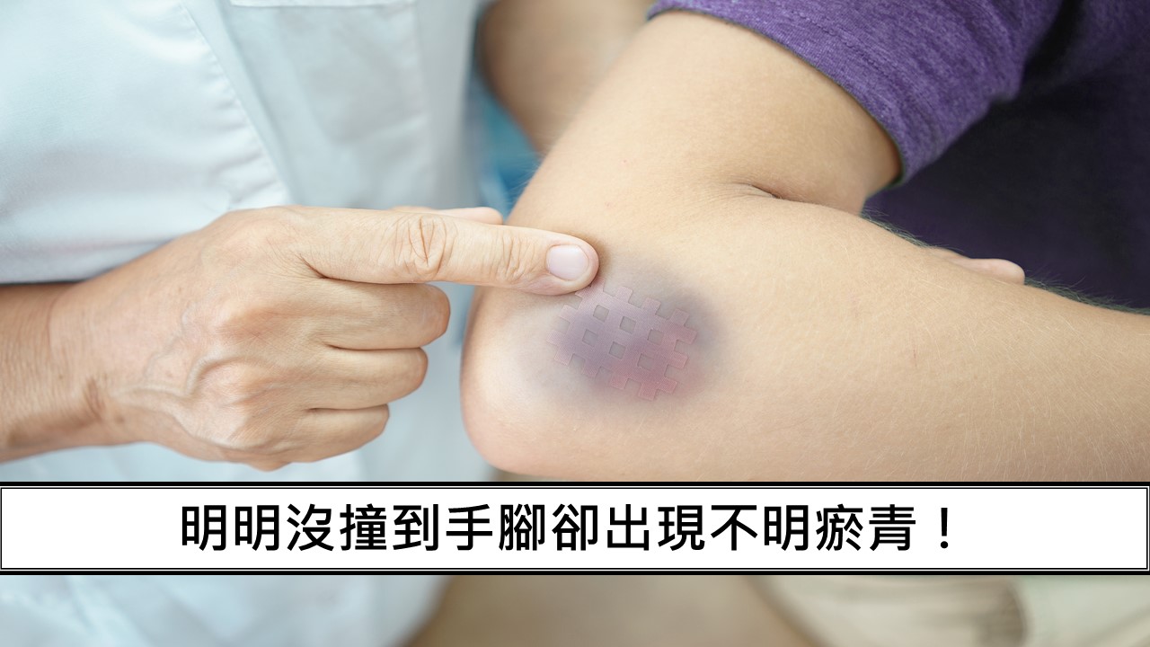 73_明明沒撞到手腳卻出現不明瘀青！