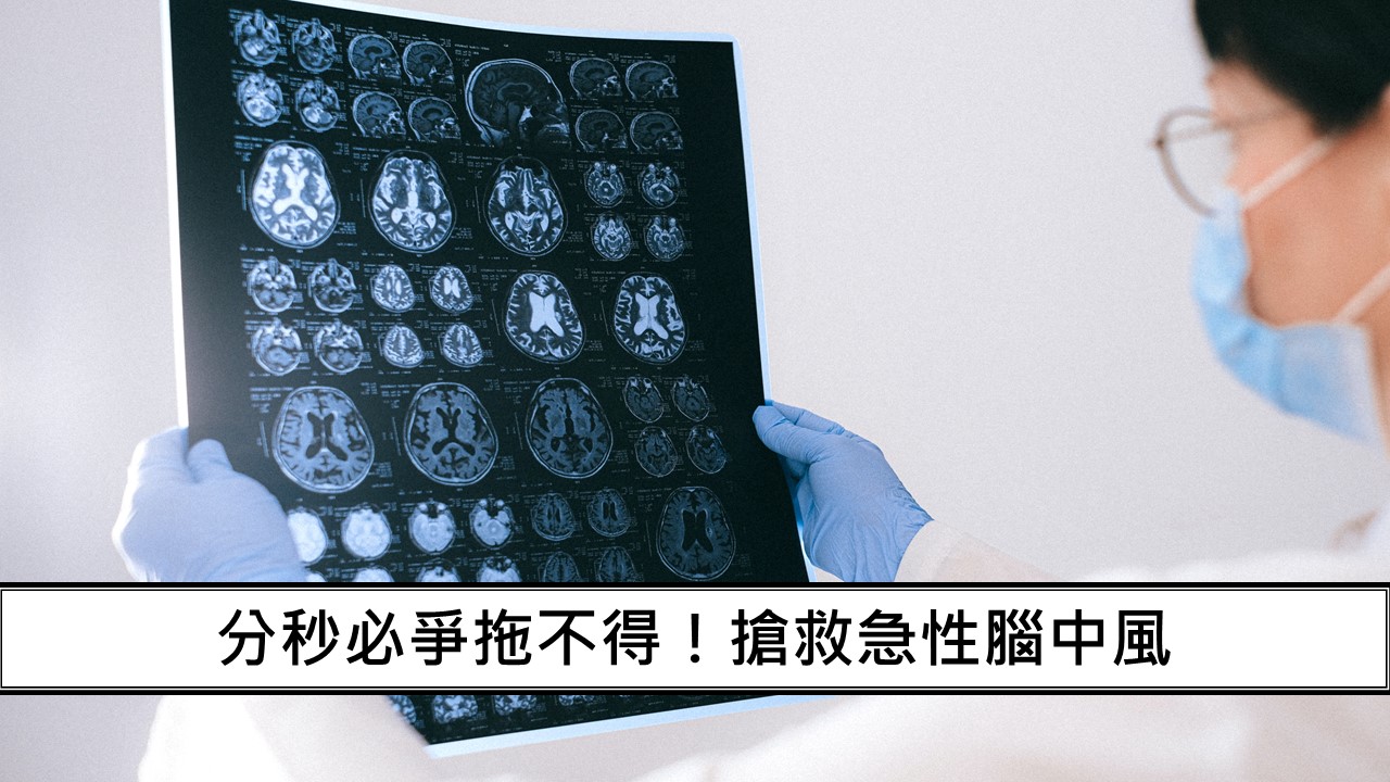 79_分秒必爭拖不得！搶救急性腦中風