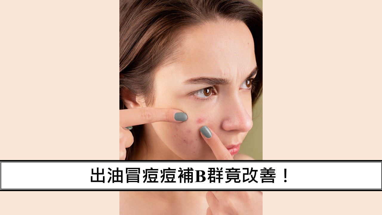 出油冒痘痘補B群竟改善！