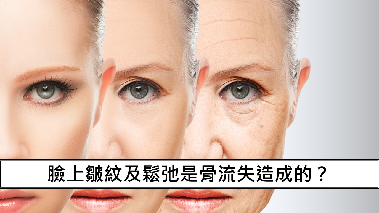 112_臉上皺紋及鬆弛是骨流失造成的？