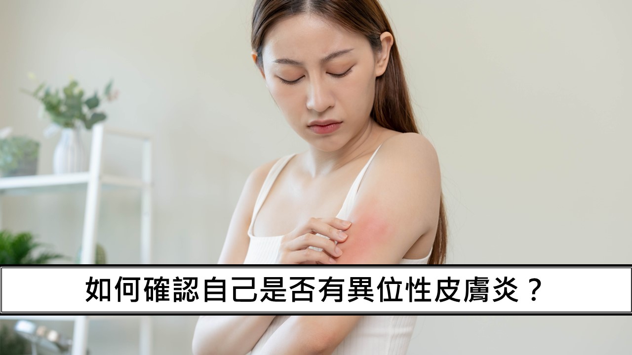 129_如何確認自己是否有異位性皮膚炎？
