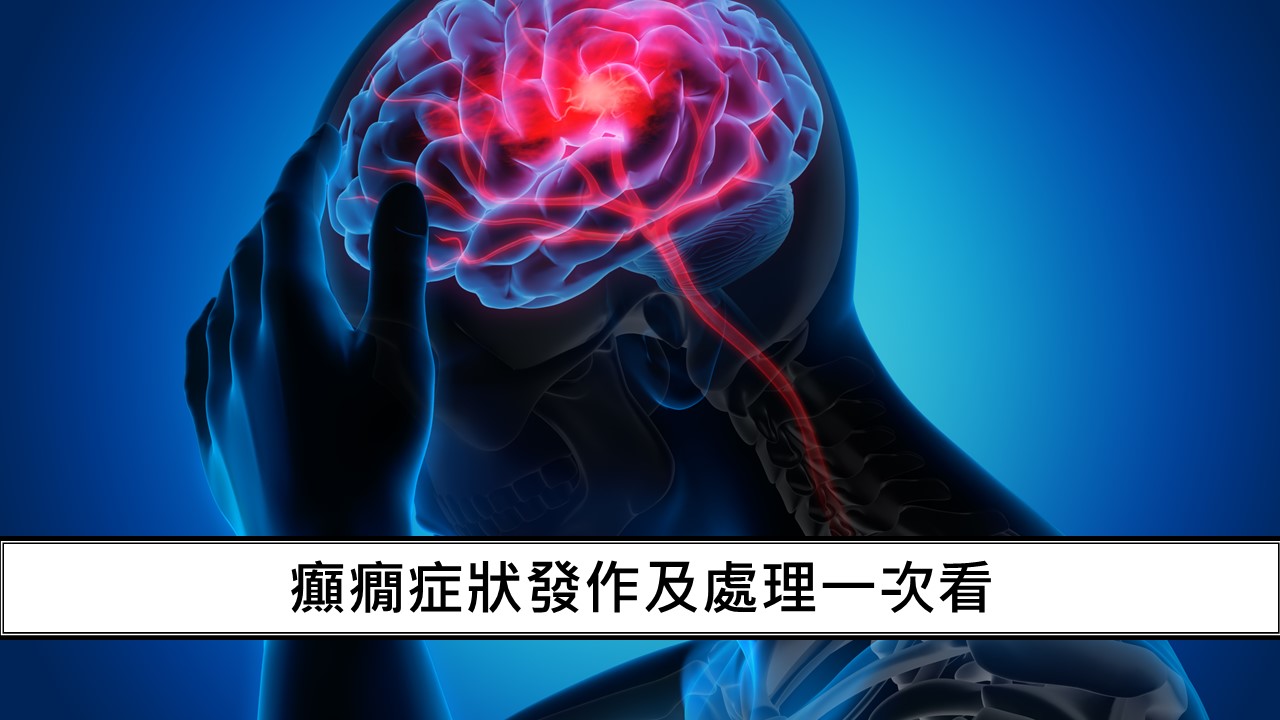 135_癲癇症狀發作及處理一次看